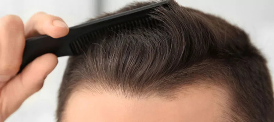 haartransplantation-ohne-rasur