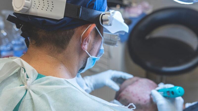 Haartransplantation 5