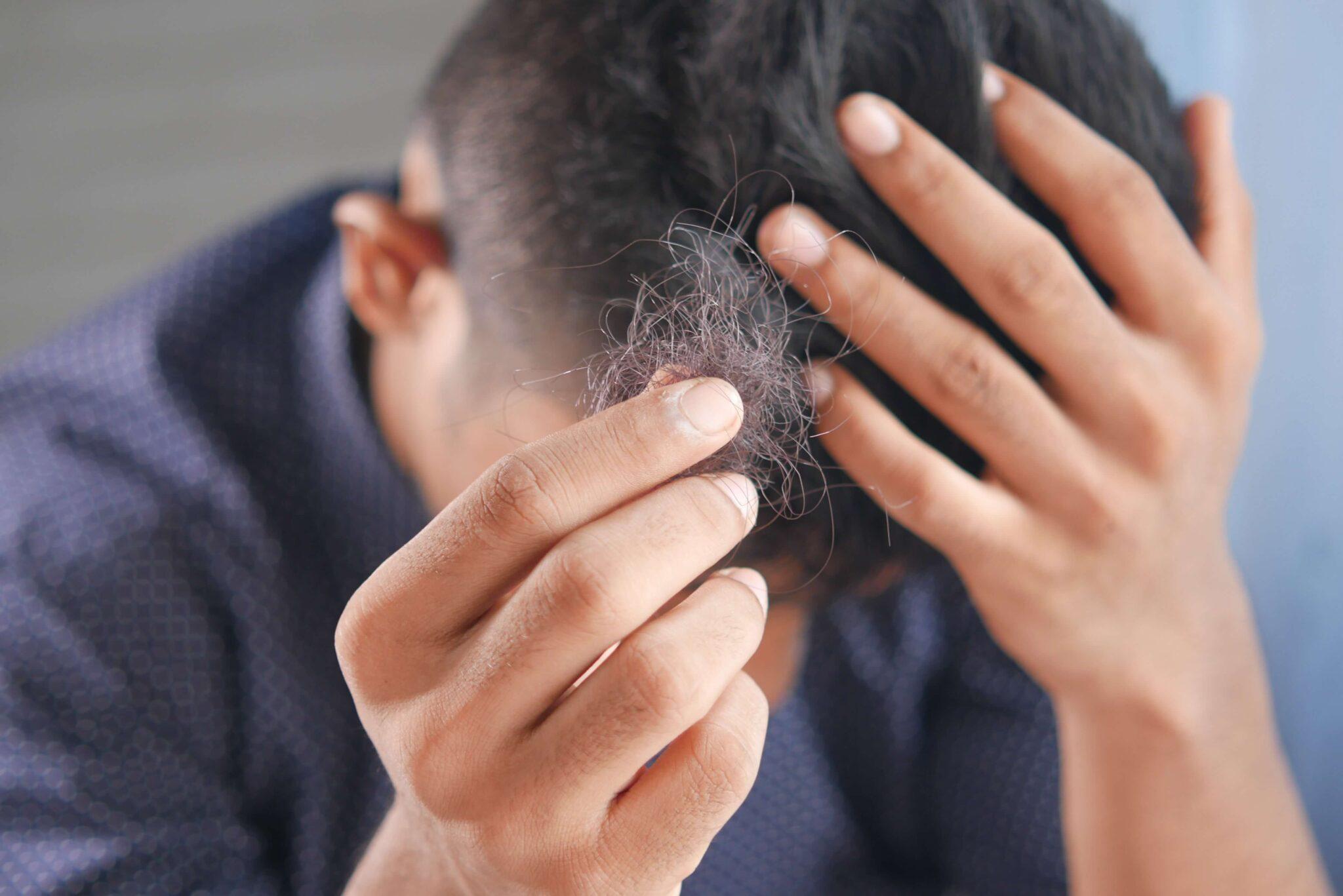 Haartransplantation5