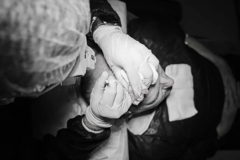 Haartransplantation 7