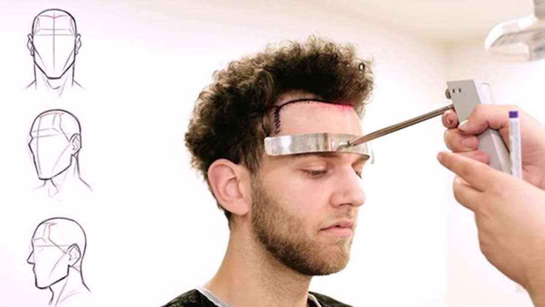 Haartransplantationsklinik