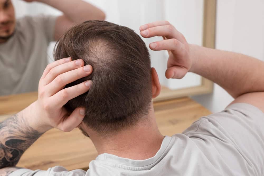 Haartransplantation 19